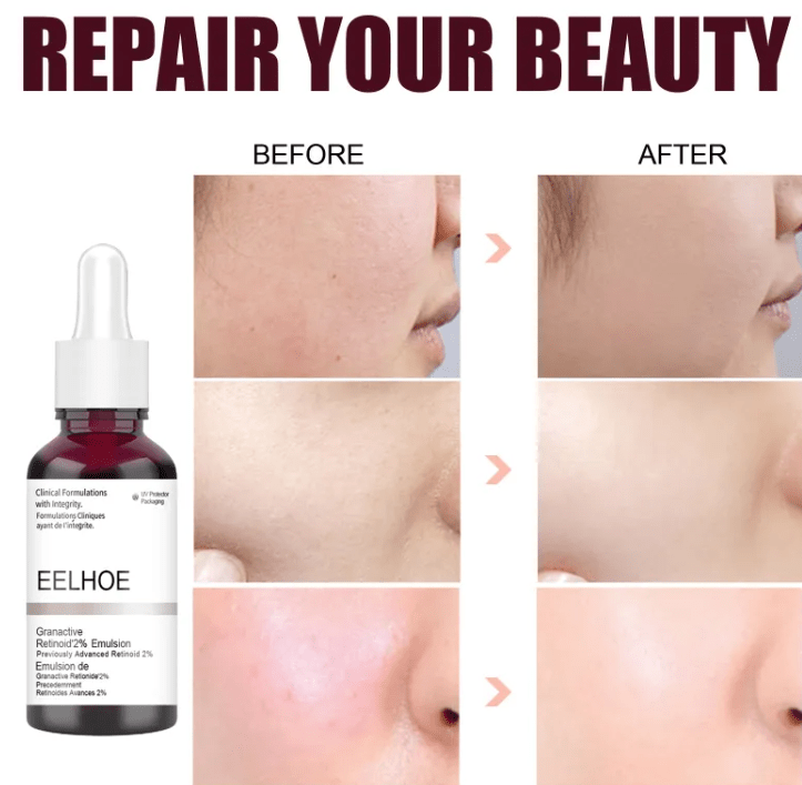 2% Retinoid Skin Refining Serum with Salicylic Acid - KZ Beauty & Wellness