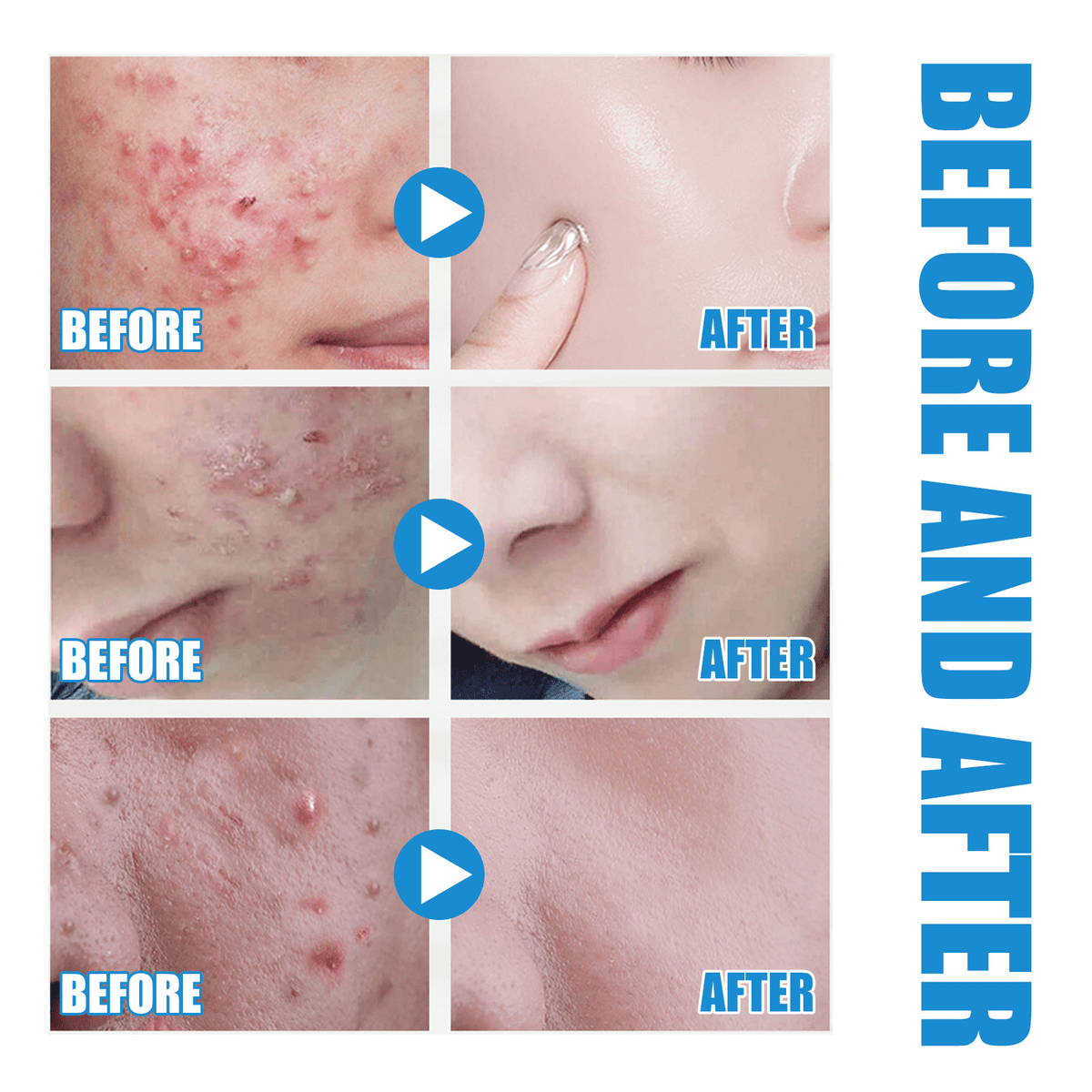 Hyaluronic Acid Hydrating Serum - KZ Beauty & Wellness