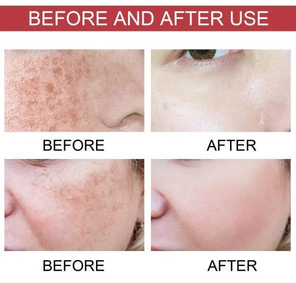 Dark Spot Correcting Serum with Niacinamide and TXA - KZ Beauty & Wellness
