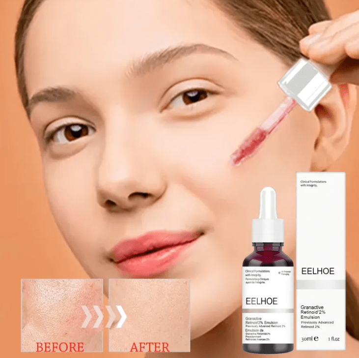2% Retinoid Skin Refining Serum with Salicylic Acid - KZ Beauty & Wellness